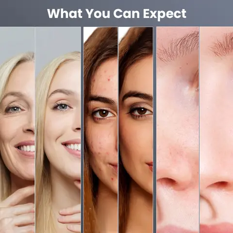 Hydro Dermabrasion Skin Lifting Spa 3in1 H2-O2 Vatten Dermabrasion Åtstramande Små Bubblor Ansiktsrengörare Mikrodermabrasion 9 best sales dermabrasion - №3