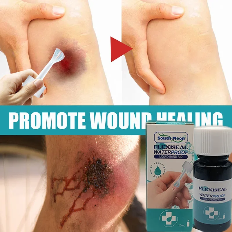 Adesivo hemostático, Adesivo hemostático, Atadura líquida impermeável respirável, Gel de cicatrização de ferida, Remendo de ferida, Spray Band-Aid