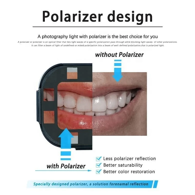 Luz de fotografia dentária de alta qualidade lâmpada de ambiente de luz de instantismo oral para fotografia