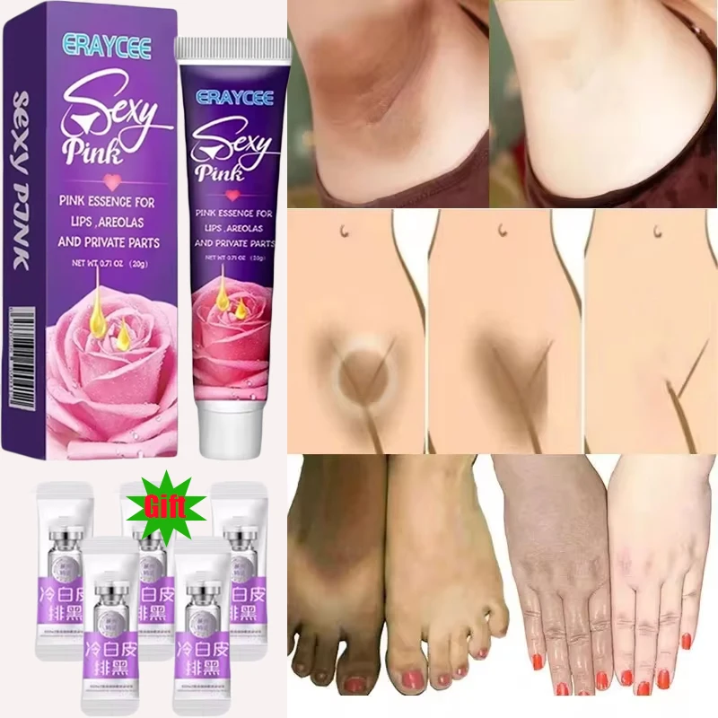 Brightening Cream For Intimate Parts Body Knees Remove Dull Pigments Brighten Serum Elbows Knuckles Lightening Skin Care Product