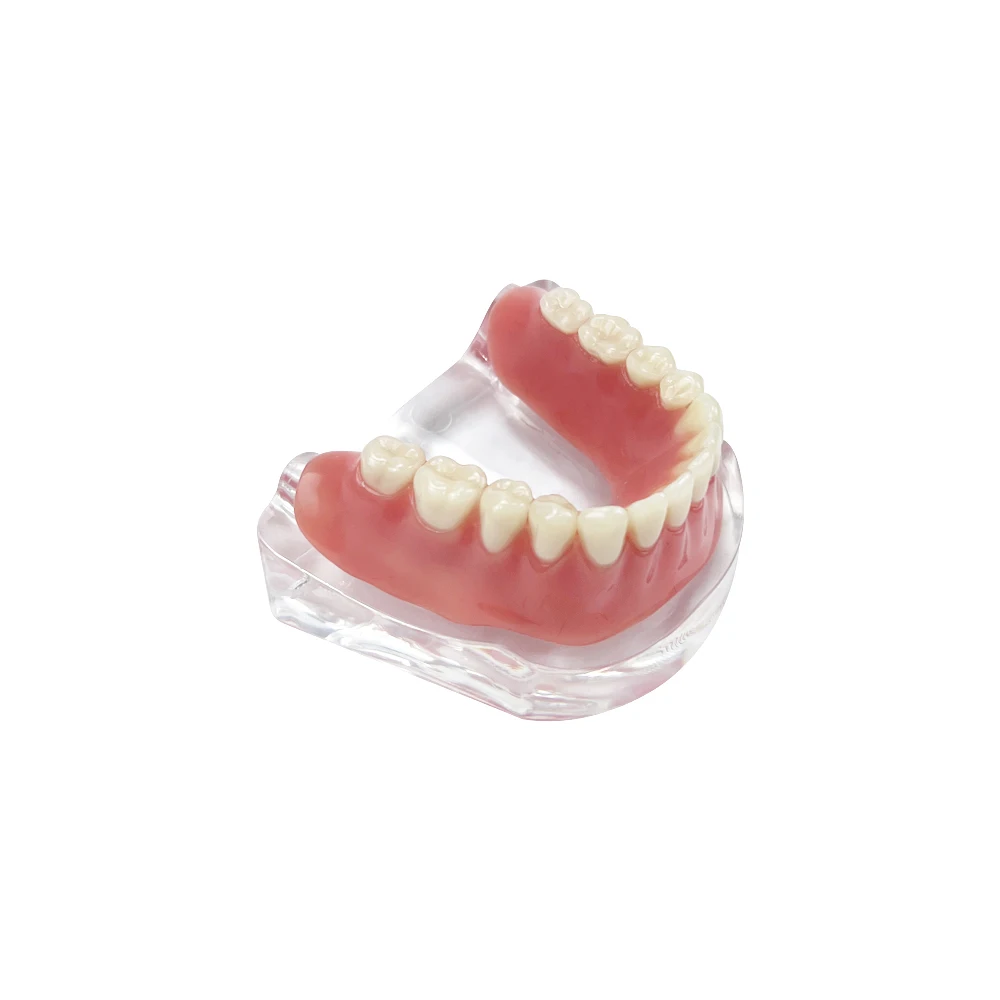 Dental Implant Overdenture Teeth Model 4 implants M6009 Typodont With Golden Bar Lower Restoration Demo Model Dental Products