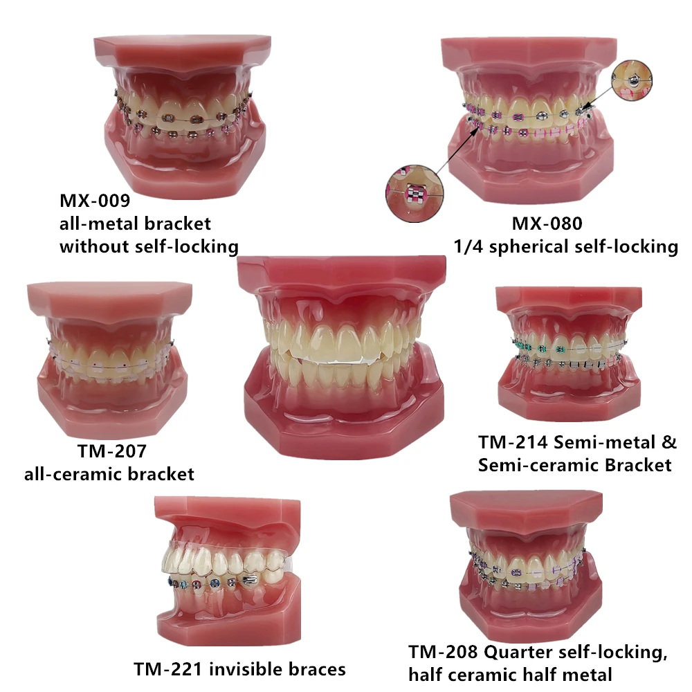 

Adult Teeth Model Dental Teaching Tooth Orthodontic Model With Brackets Ortho Treatment Typodont For Dentistry Students Dentist