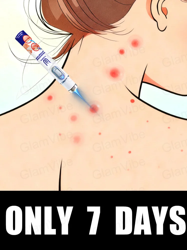 

2nd ᵍᵉⁿᵉʳᵃᵗⁱᵒⁿ ᵘᵖᵍʳᵃᵈᵉᵈ wᵃʳᵗ ⸴ ʳᵉpᵃⁱʳ wᵃʳᵗˢ ʳᵒoᵗ ⸴ ᑫᵘⁱᶜᵏˡʸ