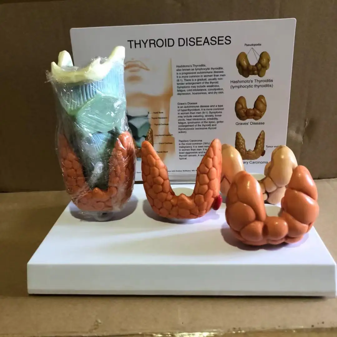 Thyroid disease Lesion Anatomical Model Thyroid Anatomy teaching mode