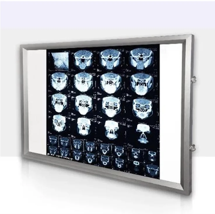 For 100-240V Hospital X-ray viewing lamp Dental orthopaedic Touch control X-Ray Film Illuminator Light Box Viewer