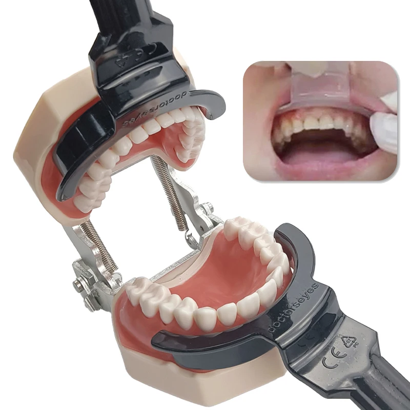 

Dental Tools Oral Lip Retractor Double-Head Lip Retractor Intraoral Cheek Mouth Opener Orthodontic Tools