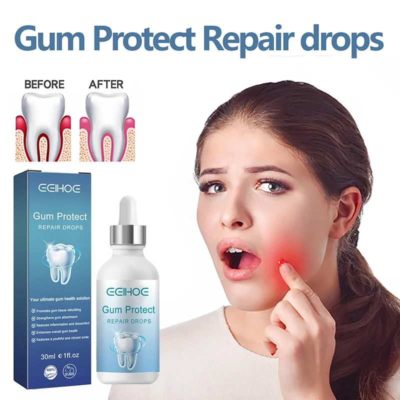 Gingival Care Drops Relieve Oral Cleaning Whitening Rapid Repair Essence Allergic Caries Alleviate Damage Professional Nursing