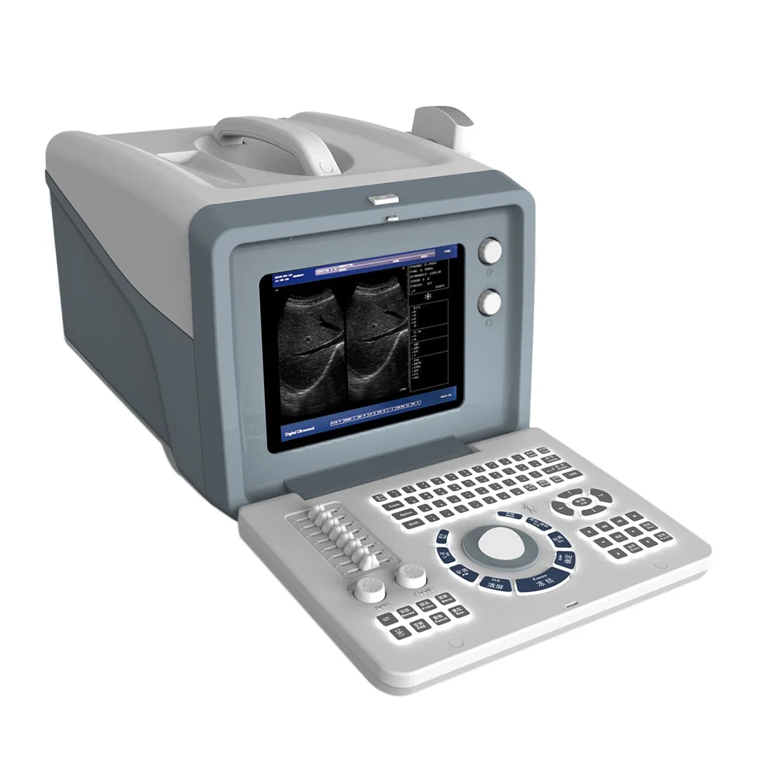 

ultrasound instruments portable digital 2D ultra sound scan machine for