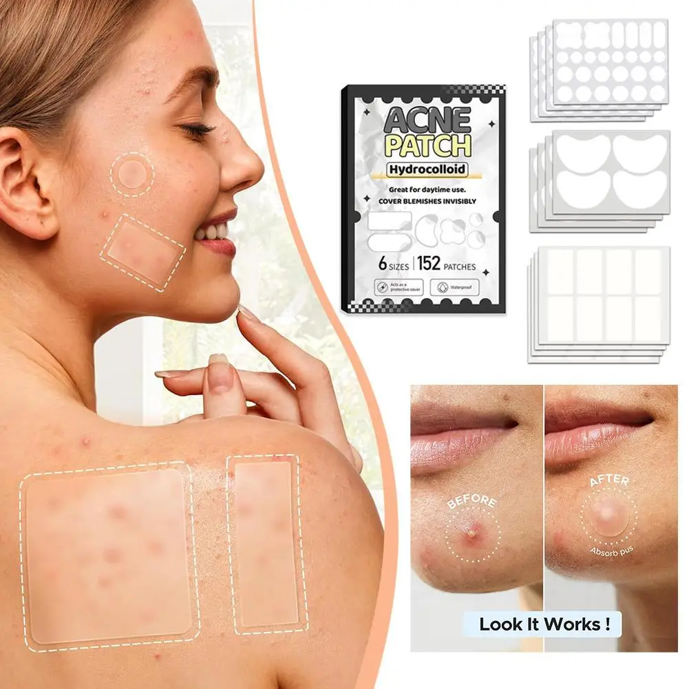 Patch maître de boutons fermés, 10/20/152/198 pièces, maquillage Invisible, masque d'absorption de la peau, respirant, soins pour sélections colloïdales Beau L2Q6