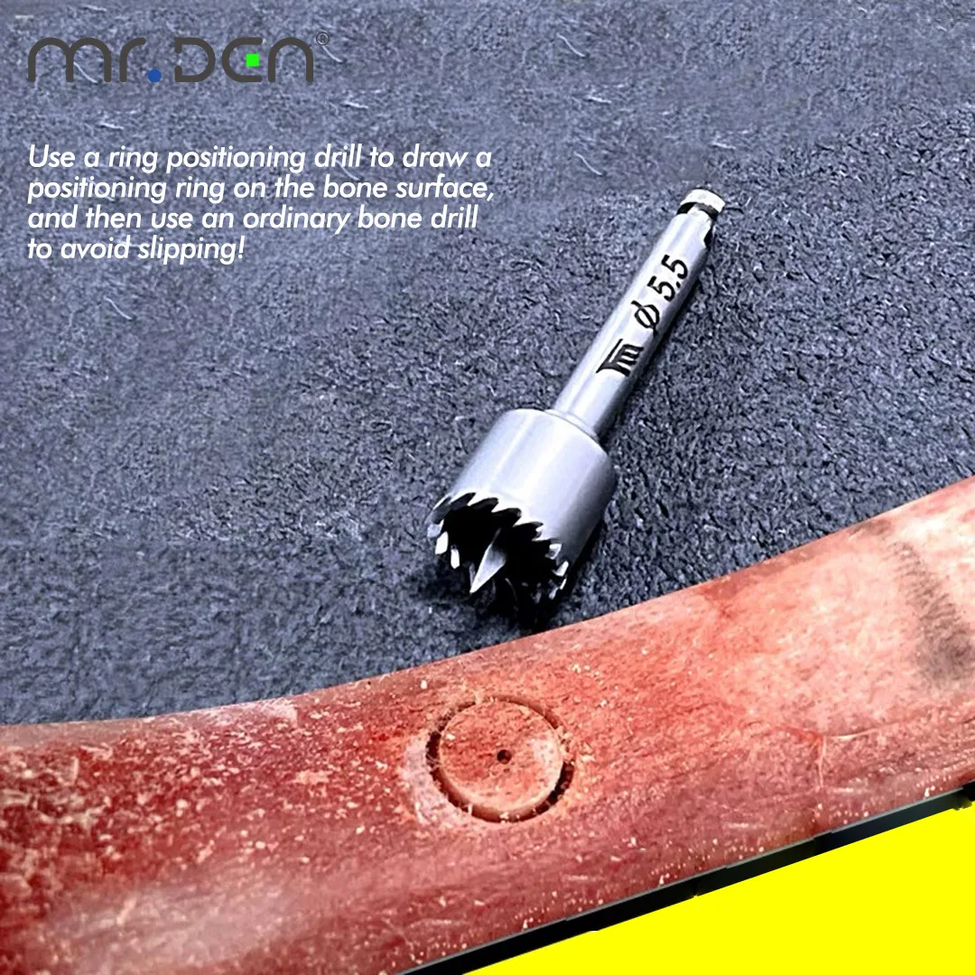 MR DEN Dental Ring Drill Implant Gingival Ring Cutter Soft Tissue Bone Extractor With Positioning Non Slip for Oral Surgery Prof