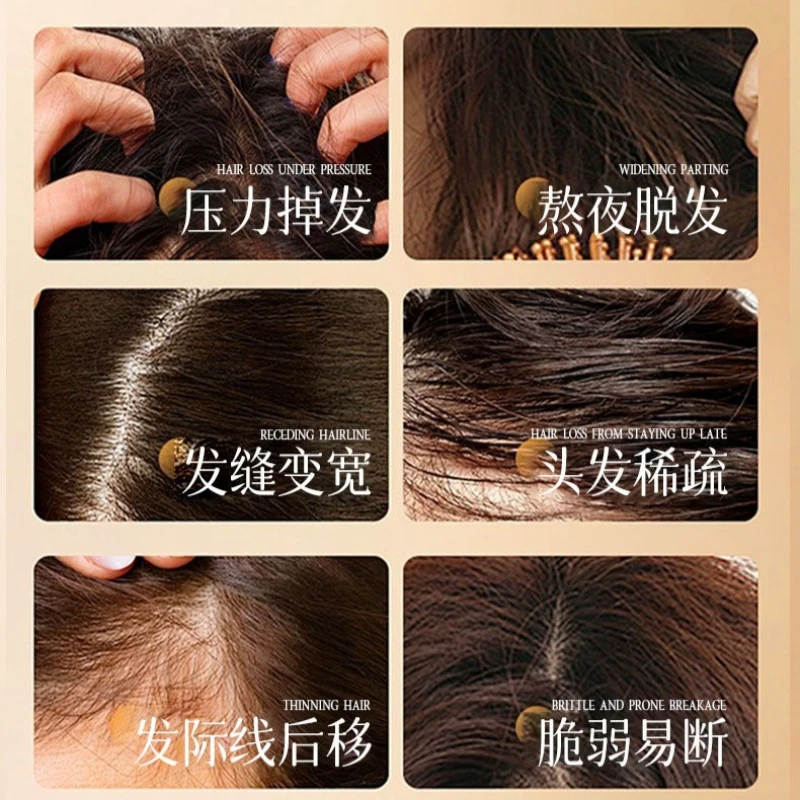 Anti-hair Loss Essence Promotes Hair Growth 100ML Scalp Serum Powerful Anti Hair Loss Treatment Chinese Medicine Therapy