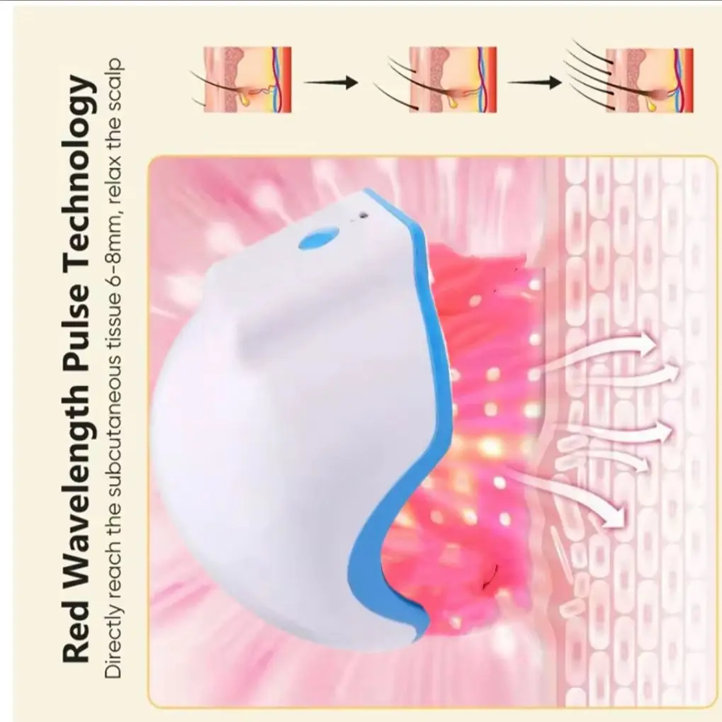 

650nm Red Light A Non-surgical Hair Growth Solution with No Side Effects, Effectively Combating Hereditary Hair Loss