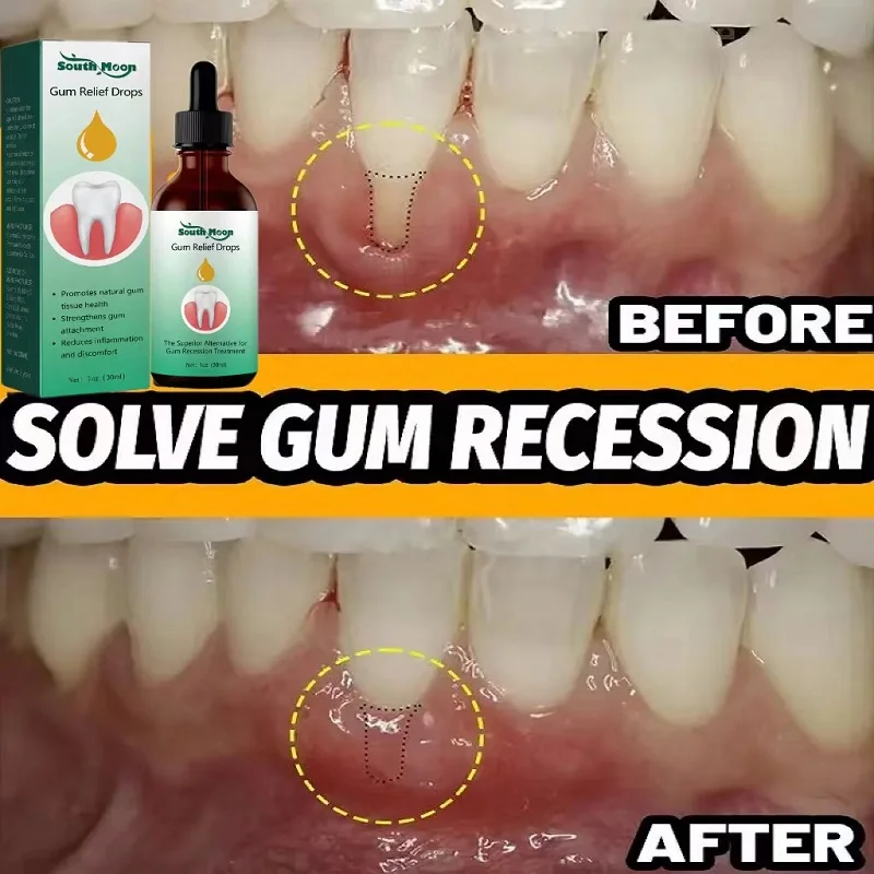 Rapid Repair Gums Serum Effectively Relieve Tooth Allergy Dental Caries Relieve Tooth Damage Drops Tooth Cleaning Toothpaste