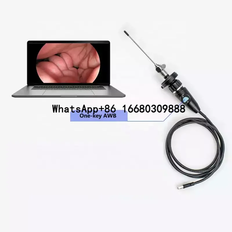 Portable Optical Adapter Medical Full HD Endoscope  Unit System for Veterinary Clinic