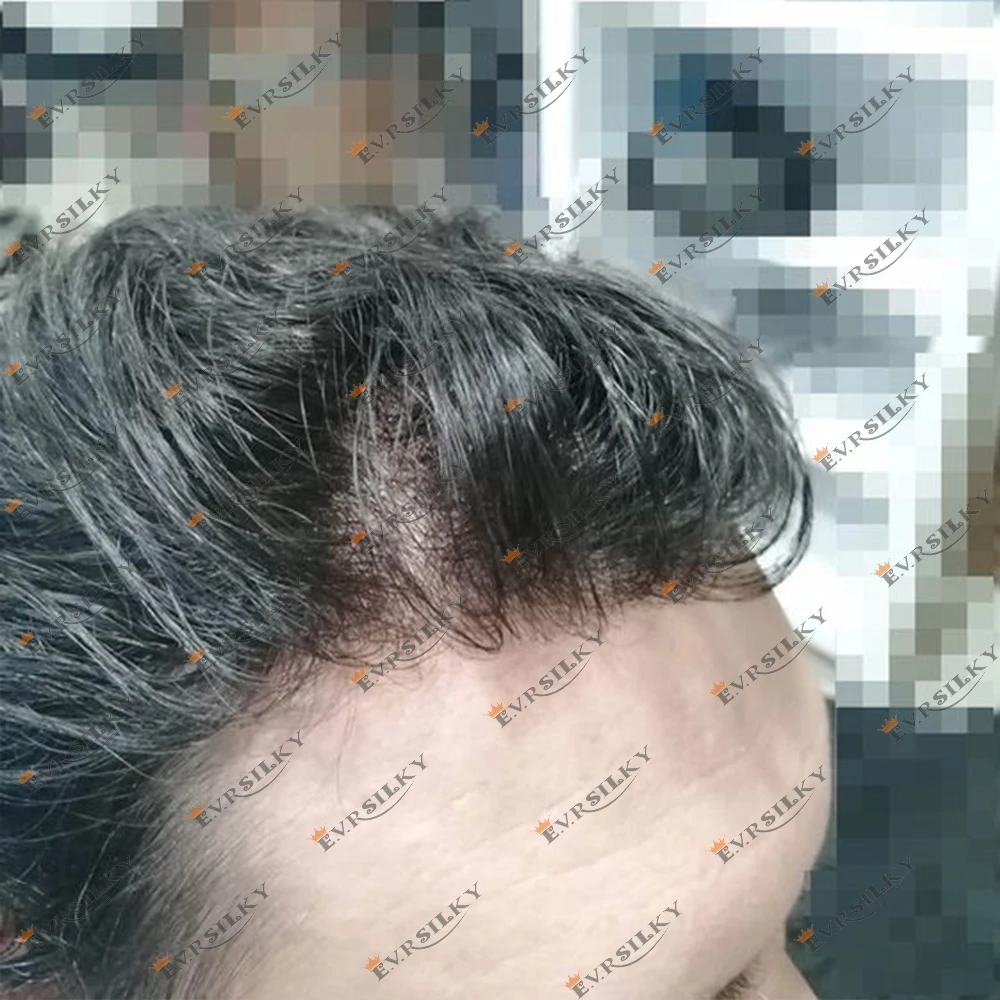 

Undetectable Ultra Thin Micro Skin Base Man's Wigs 0.02mm Super Natural Hairline Men Toupee Black Human Hair Capillar Prosthesi