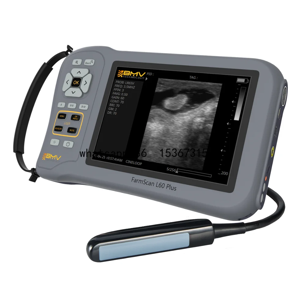 Best selling FarmScan L60 portable veterinary ultrasound scanner for farm animals