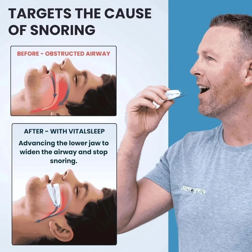 

Adjustable Anti Snoring Mouth Guard Stop Snoring Teeth Mouthguard Stop Bruxism Device Anti-Snoring Mouthpiece