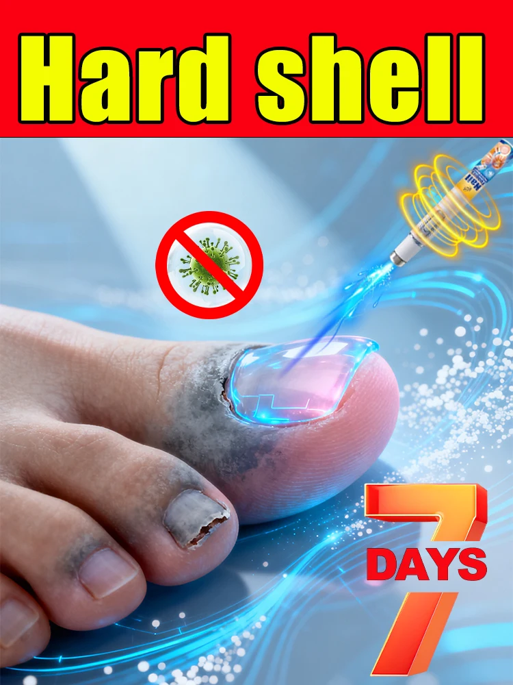 

The best nail fungus products of 2025, say goodbye to nail fungus in 7 days