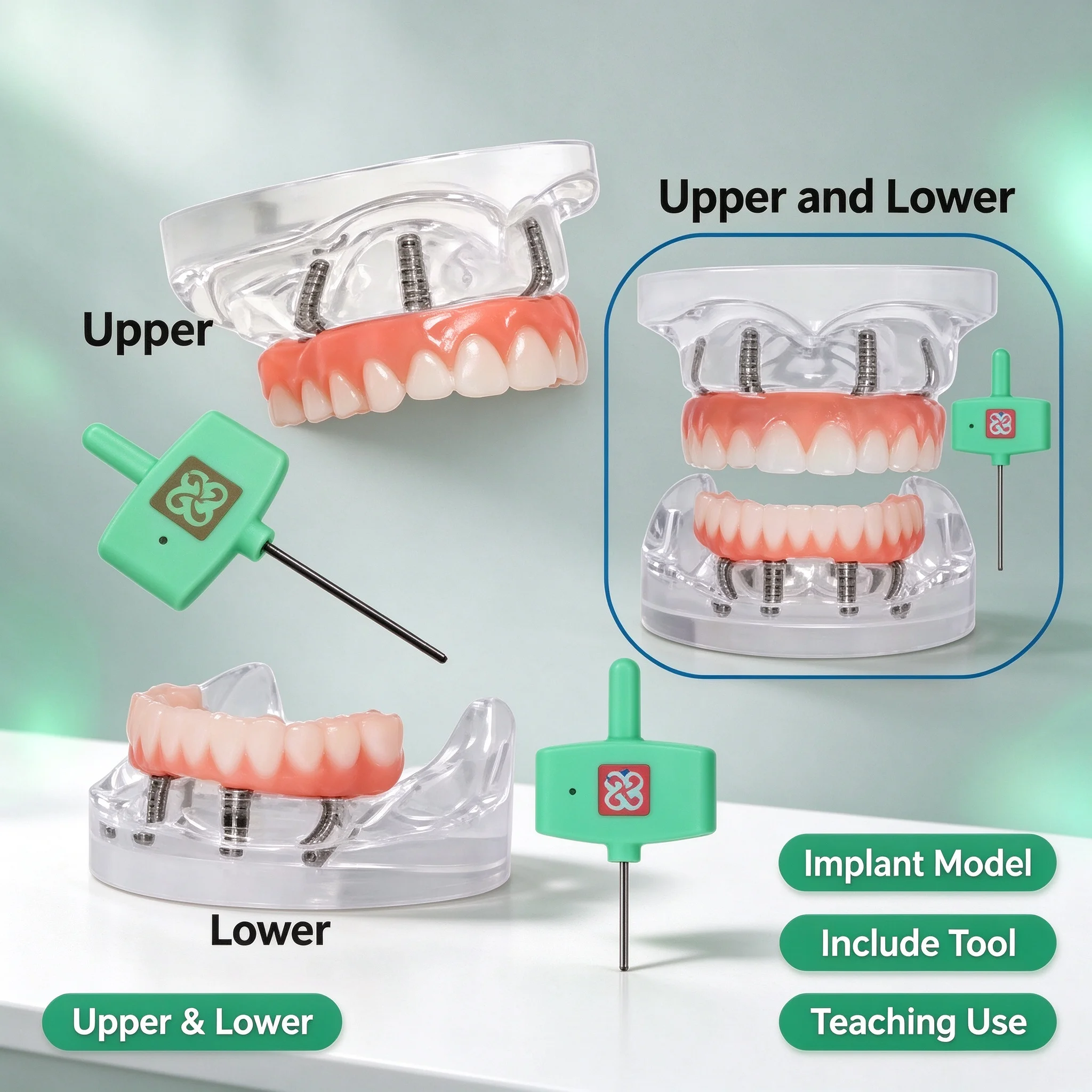 Dental Implant Upper/Lower Jaw Restoration Teeth Model All on 4 Overdenture Model With 4 Removable Screws for Teaching Studying