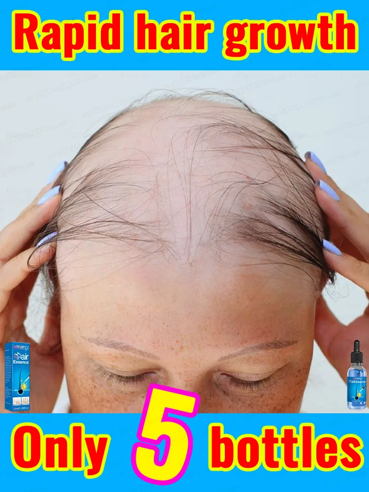 Hot sale, buyers will buy again, hair is getting more and more, say goodbye to baldness, sparse hair starts to become thick