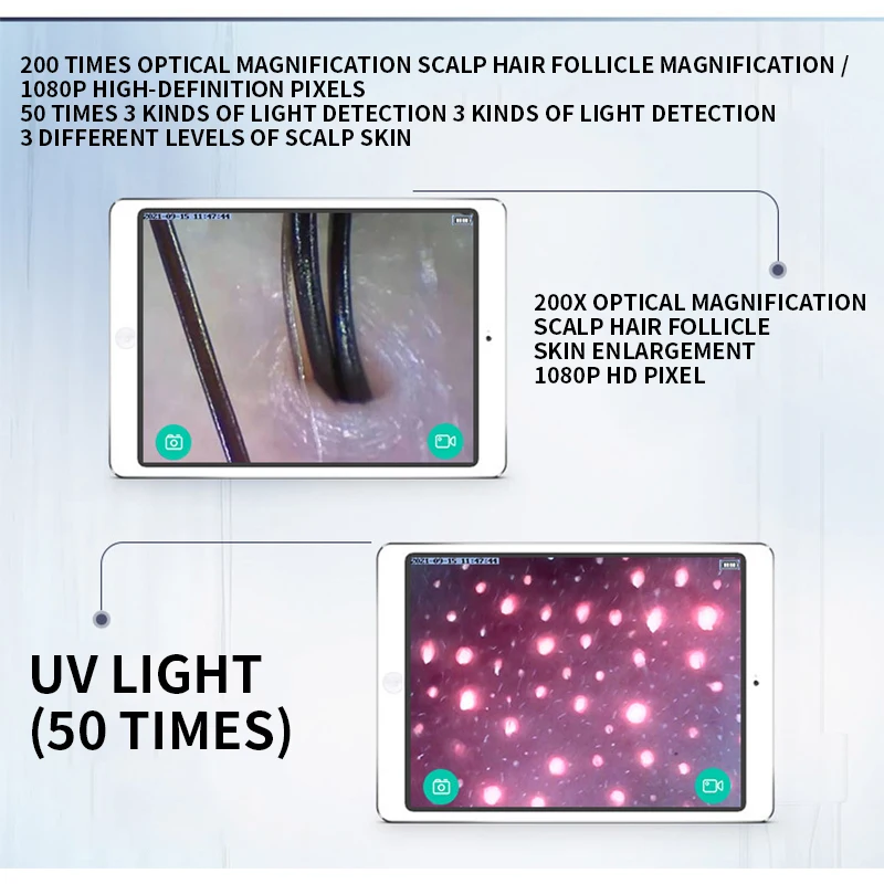WIFI Scalp/Skin /Hair follicle Detection Testing Analysis Magnifier UV Skin Analyzer Professional 50X/200X Facial Skin Detector
