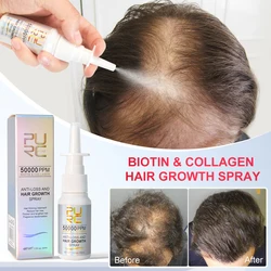 PURC Biotin Hair Growth Products for Man Women Anti Hair Loss Oil Scalp Treatment Serum Spray Thicken Fast Regrowth Hair Care