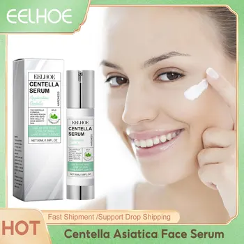 센텔라 페이셜 세럼 수화 피부 균일 톤 모이스춰 라이징 스킨 안티 주근깨 둔한 피부 퍼밍 히알루 론산 페이스 로션