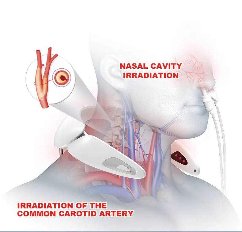 High Demand Products Medical Physiotherapy and Rehabilitation Equipment Cervical Osteoarthritis Sinusitis Treatment Device