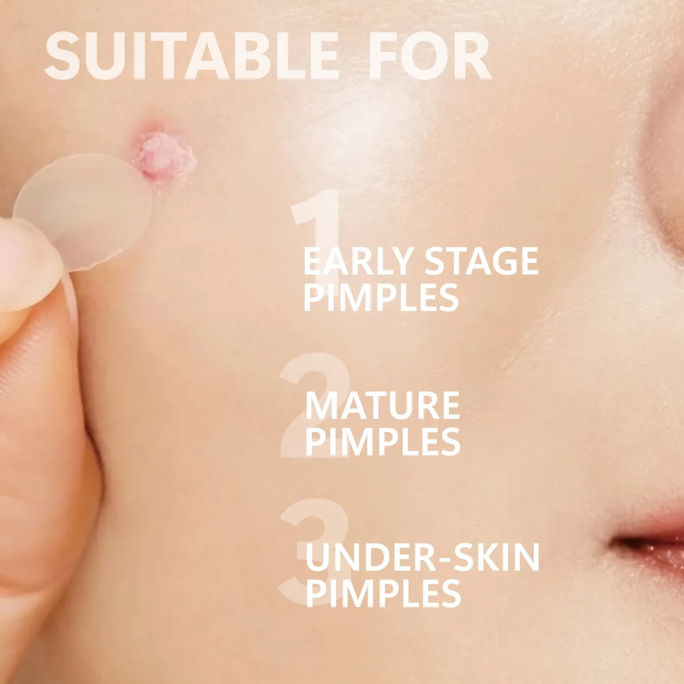 رقع حب الشباب ذات السهام الدقيقة بين عشية وضحاها - يذل العيوب أثناء النوم بتقنية الغروانية المائية غير المرئية للبشرة الواضحة. #3