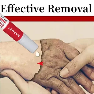 Gesichtscreme Bleiche, Sommersprossen, abgedunkelter Melasmaentfernung, Blitzmakler, Melaninpigmentierung, Illumination, Anti-Aging, Schönheitspflege 8 Hauptverkäufe Clarader Mess - №8