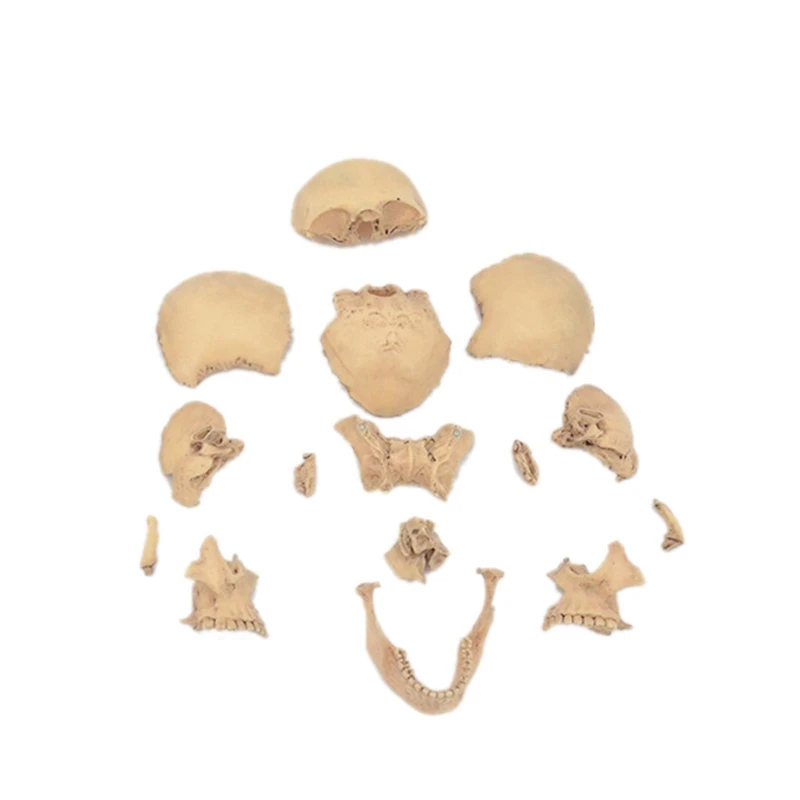 4D Disassembled Skull Anatomical Model Detachable Teaching Tool