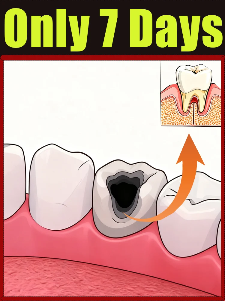 2nd generation new upgrade, tartar remover dissolves tartar and removes stains