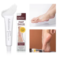 Foot Repair Gel Feet Care Mask Foot Cream Hand Cracked Repair Cream Removal Dead Skin Hand Feet Care Exfoliation 30g