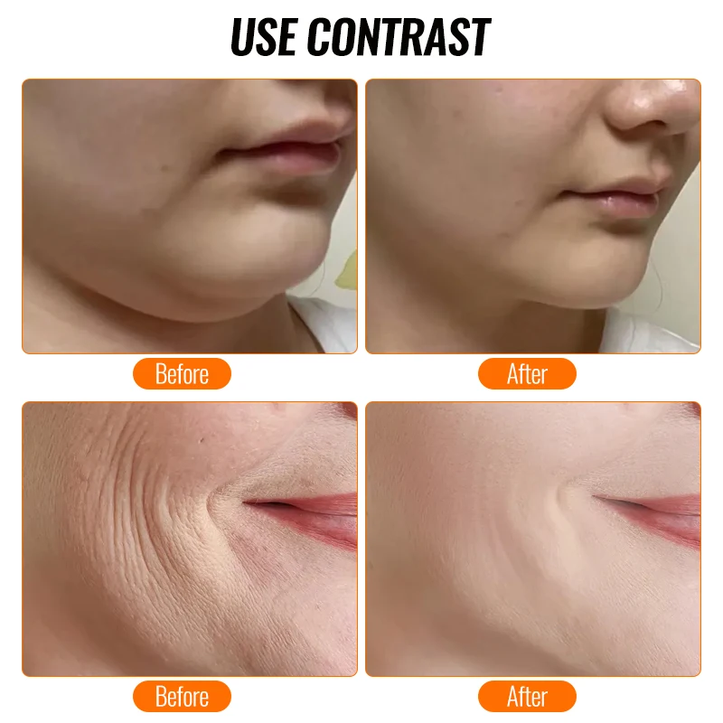 2025 NOUVEAU instrument de beauté à ultrasons portable pour le lifting et le serrage du visage pour éliminer les plis nasolabiaux et les rides à la maison