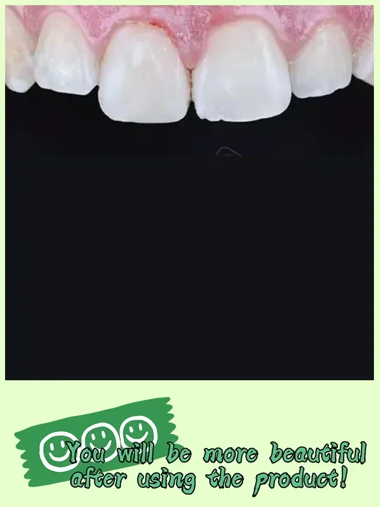 3R إصلاح سريع للتسوس إزالة البقع البلاكية تسوس تبييض اصفرار إصلاح تبييض الأسنان #5