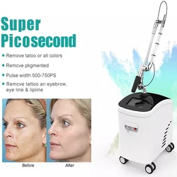 Profession Super Picosecond Removal of Melanin Tattoo Removal 532nm 755nm 1064nm Beauty Salon Whitening and Tender Skin Machine