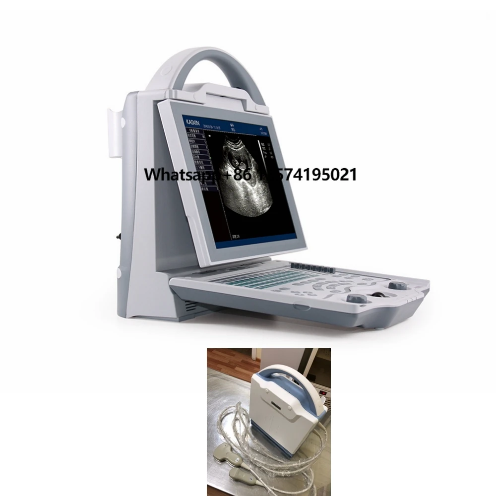 KX5600V Good Quality Vet-use Sheep/goat/cow Ultrasound Scanner / Portable Veterinary Ultrasound Machine