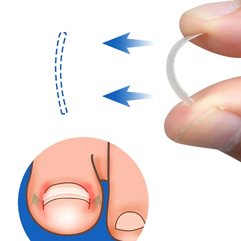 10 قطعة ملصقات تصحيح تو تصحيح الأظافر التصحيح نام أظافر مستقيم لتخفيف الآلام بارونيشيا شفاء باديكير أداة