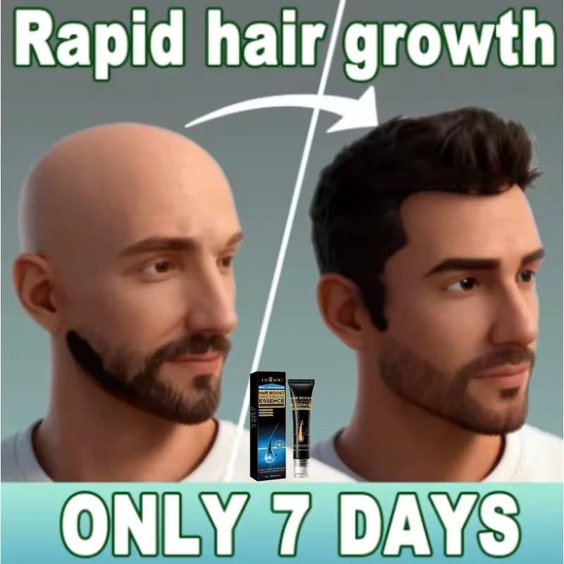 

887s The dormant hair follicles awaken, and the head becomes more luxuriant