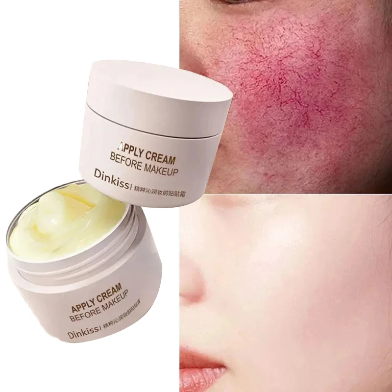 Effective Facial Redness Repair Cream Rosacea Treat Sensitive Skin Dryness Moisturizer Hydrating Sooth Lotion Korean Cosmetics