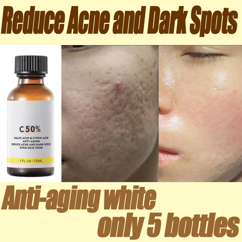 

Reduce Acne and Dark Spots Essence Chemical Exfoliants Moisturizer Face Oils Salicylic Acid Face Peel Neutraliser
