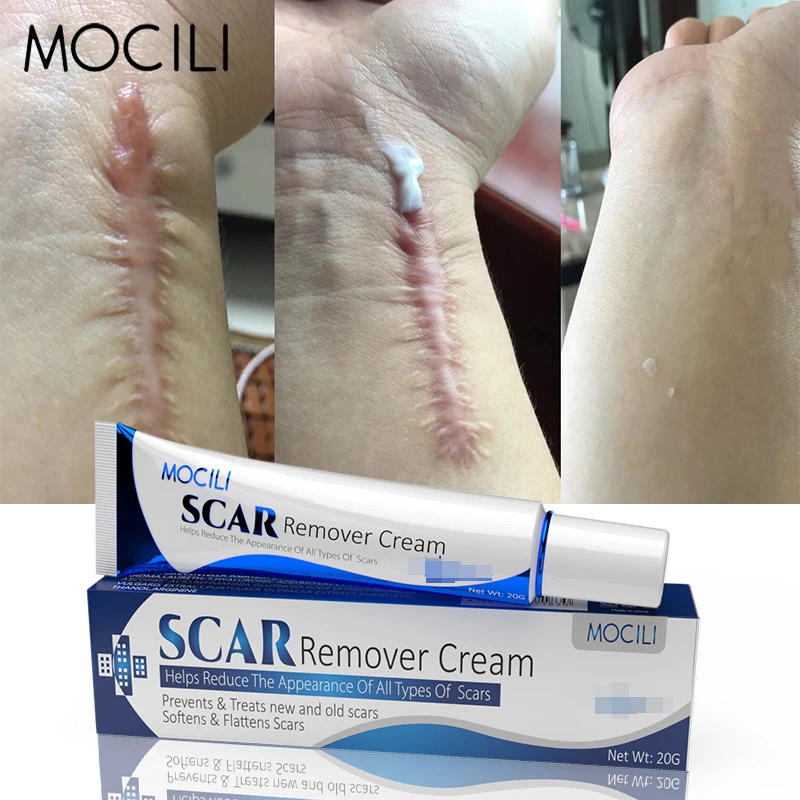 Herbal Scar Removal Cream Treatment Burn Surgical Scar Stretch Marks Acne Spots Repair Pigmentation Body Smooth Beauty Skin Care