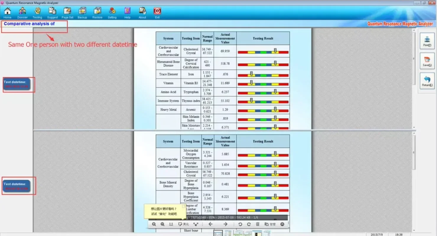 Best quality high accuracy quantum health test machine body system