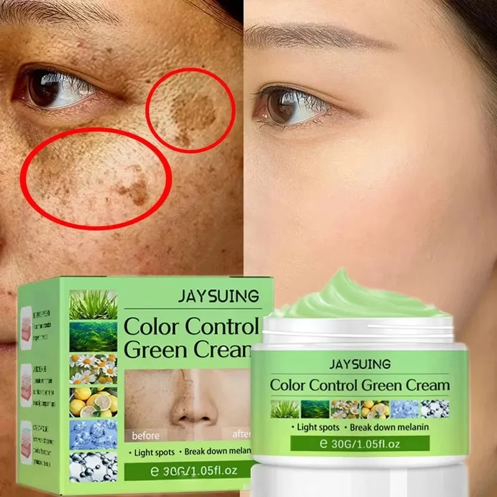 Whitening Freckle Face Cream Remove Melasma Dark Spot Lightening Melanin Brightening Melasma Anti-Aging Skin Care Beauty Product