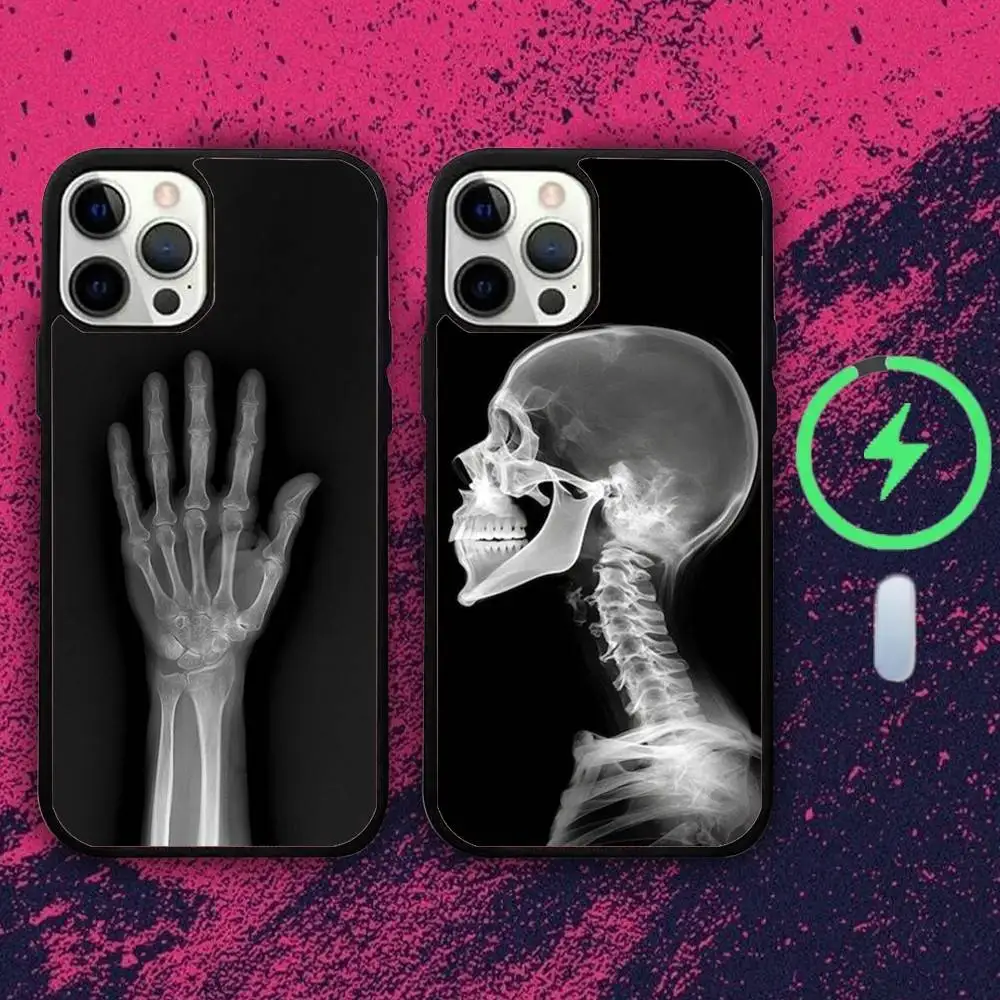 

R-Radiological Human Skeletons Phone Case For iPhone 16e,16,15,14,13,12,11,Plus,Pro,Max,Mini Magsafe Magnetic Wireless Charging