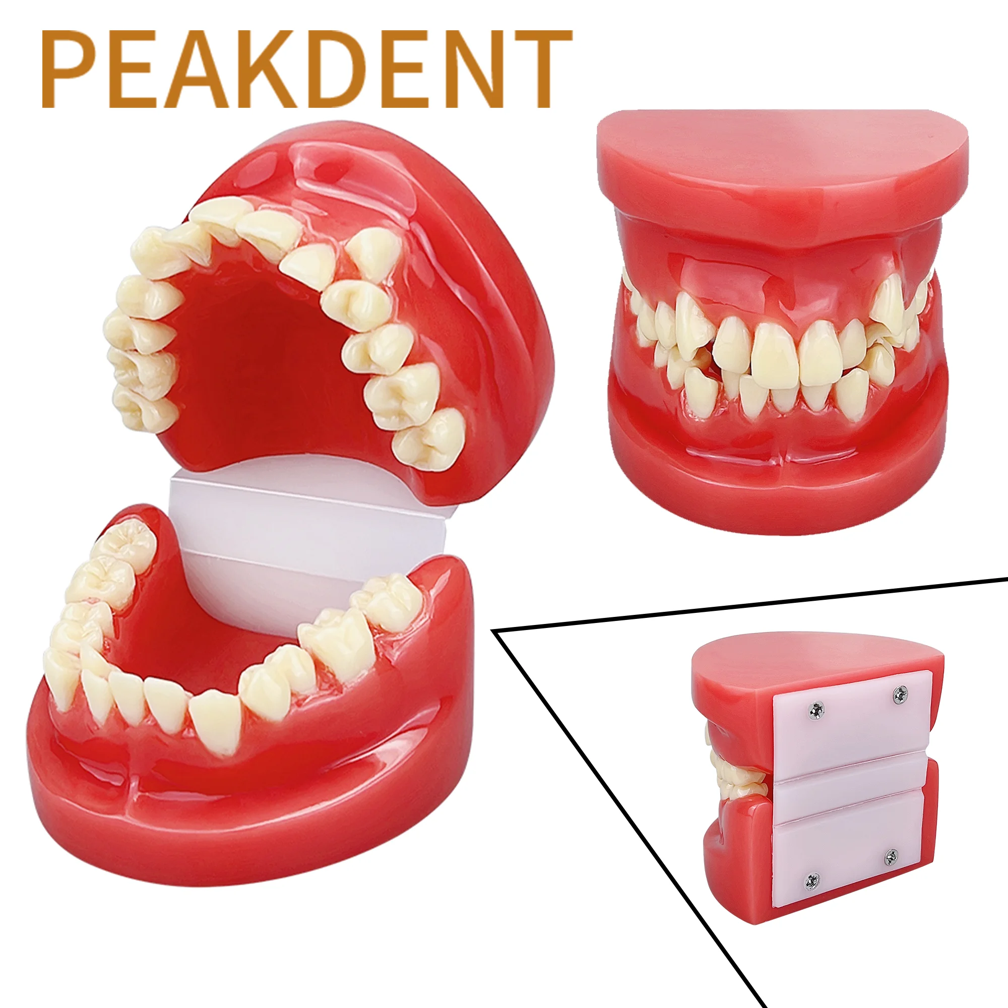 Dental Teeth Model Dental Teeth Malocclusion Model Practice Teaching Training Communication Model Oral Medical Tooth Models