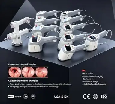 Trolley Mounted HD Kernel KN-2200A Professional Women's Care Imaging Device 2.1M Pixel High Definition for Medical Use