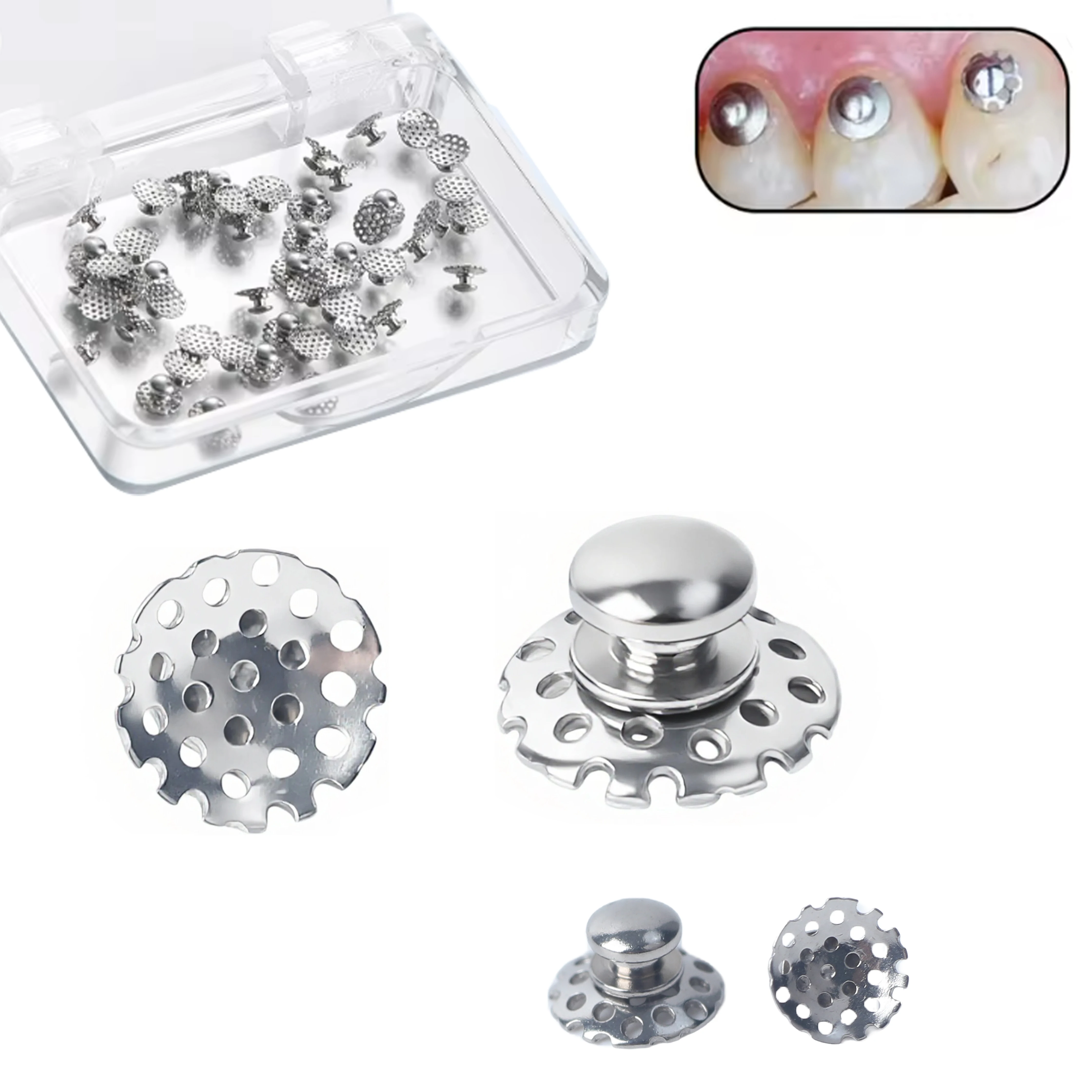 

100 шт./10 упаковок: Металлические ортодонтические лингвальные кнопки с круглым отверстием для стоматологии