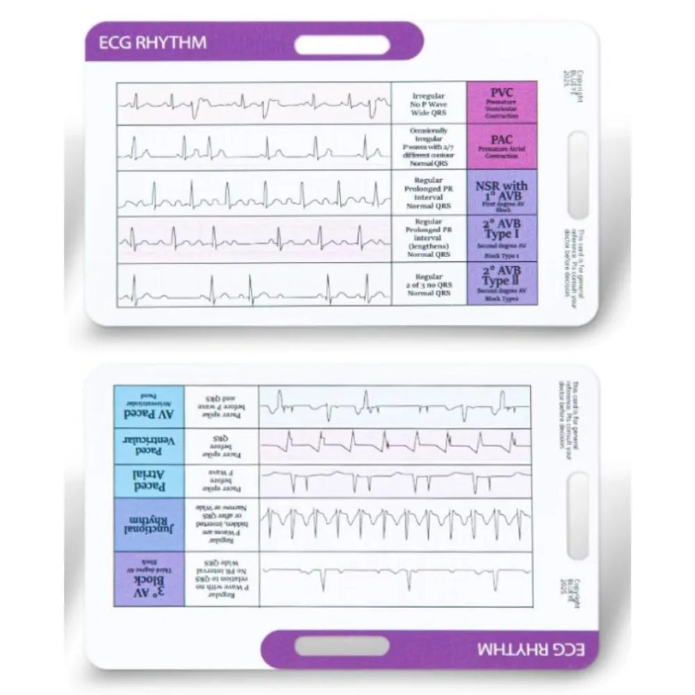 Quick Reference Ekg…