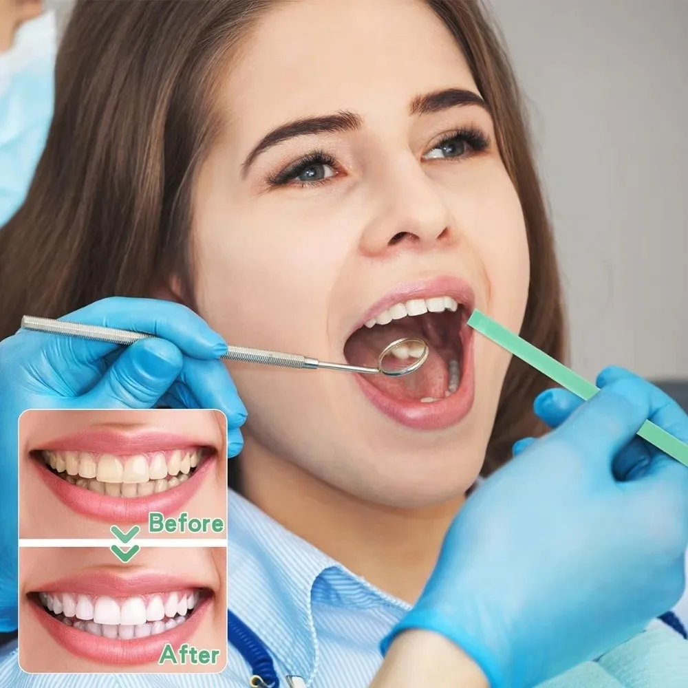 20/30/ 50um Colored Rolled Molar Strips Tooth Finishing Strips Tooth Interdental Sanding Surface Dental Tool Polishing Strips